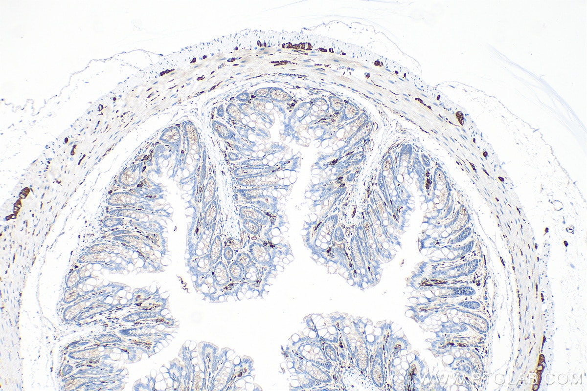 Immunohistochemistry (IHC) staining of mouse colon tissue using NCAM1/CD56 Polyclonal antibody (14255-1-AP)