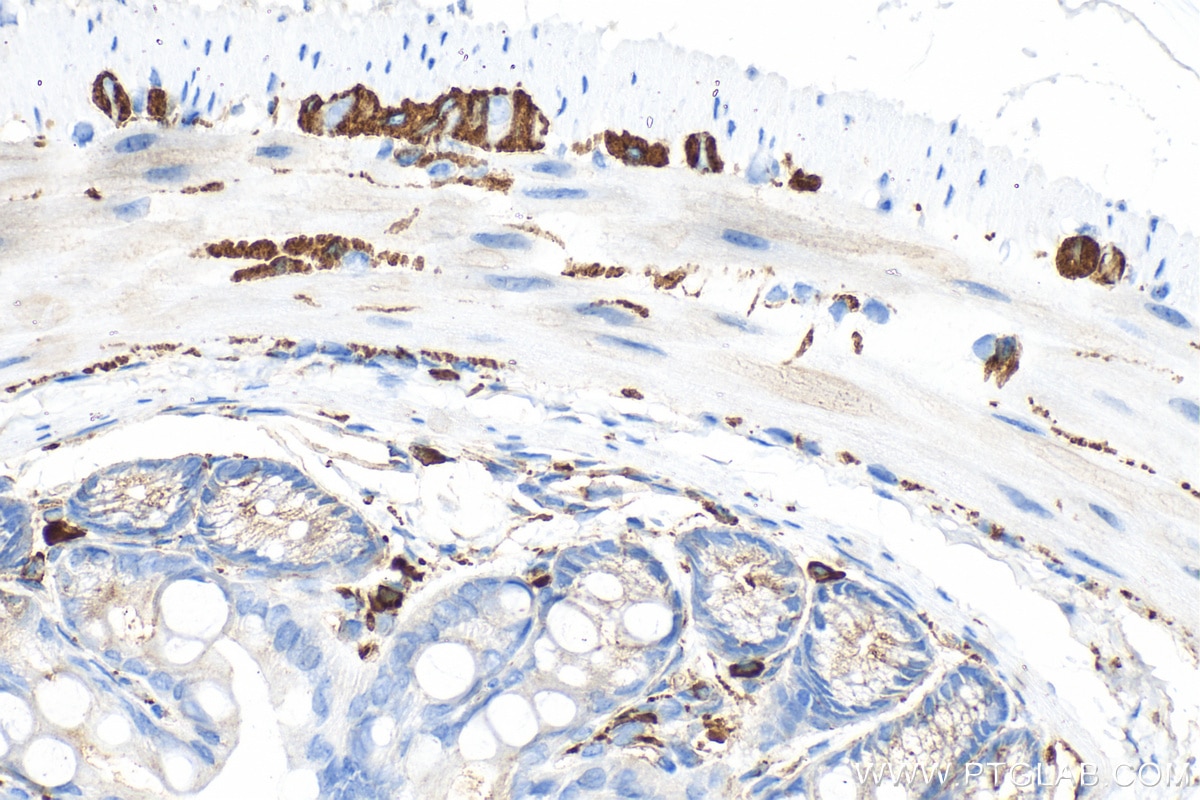Immunohistochemistry (IHC) staining of mouse colon tissue using NCAM1/CD56 Polyclonal antibody (14255-1-AP)