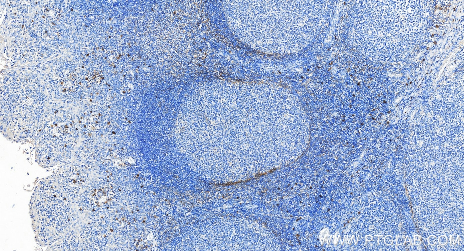 Immunohistochemistry (IHC) staining of human tonsillitis tissue using NCAM1/CD56 Polyclonal antibody (14255-1-AP)