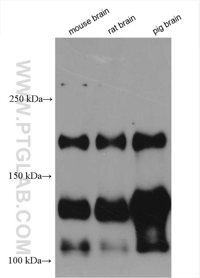 Western Blot (WB) analysis of various lysates using NCAM1/CD56 Polyclonal antibody (14255-1-AP)
