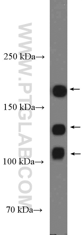 Western Blot (WB) analysis of mouse brain tissue using NCAM1/CD56 Polyclonal antibody (14255-1-AP)