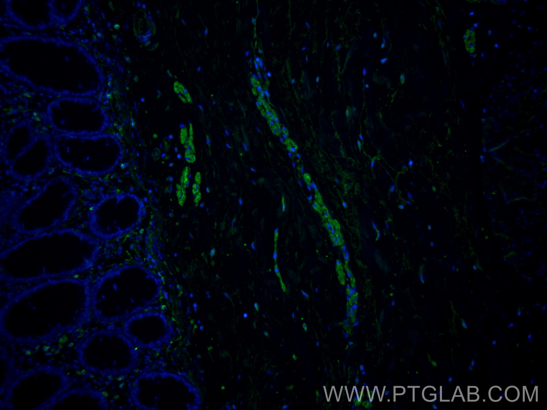 Immunofluorescence (IF) / fluorescent staining of human colon tissue using NCAM1/CD56 Monoclonal antibody (60238-1-Ig)