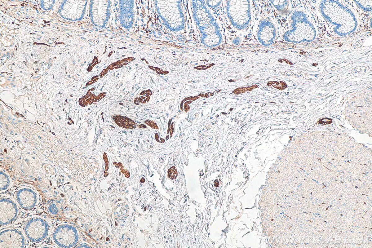 IHC staining of human colon using 60238-1-Ig