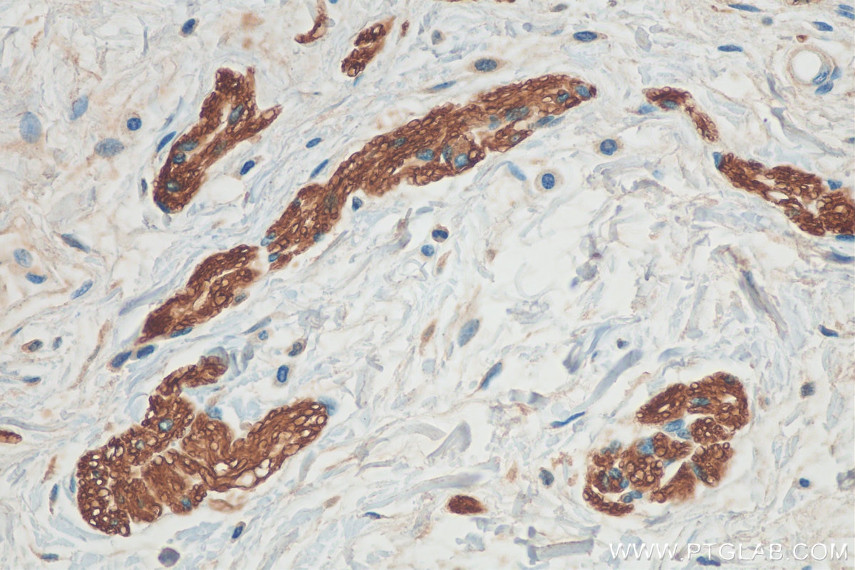 Immunohistochemistry (IHC) staining of human colon tissue using NCAM1/CD56 Monoclonal antibody (60238-1-Ig)