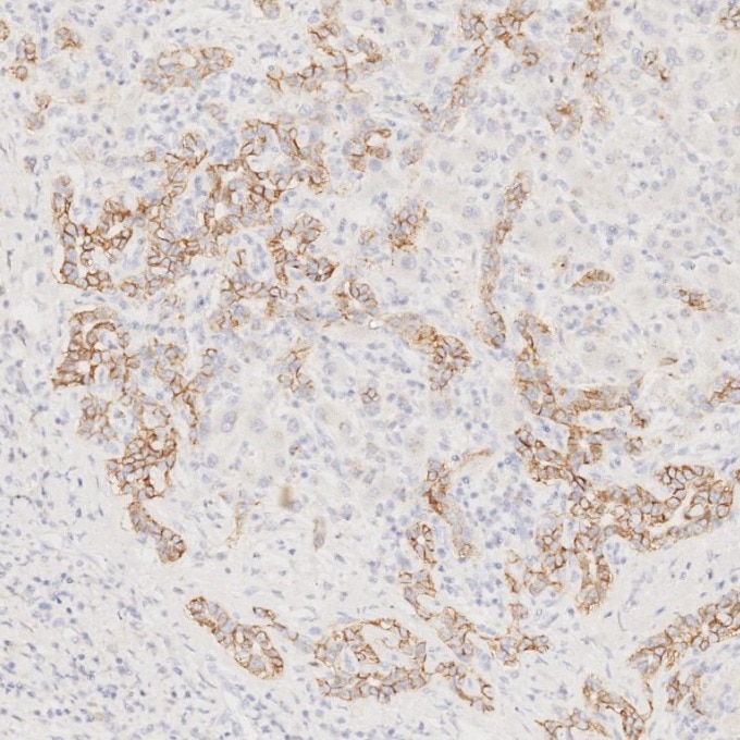 IHC staining of human liver using 60238-1-Ig Immunohistochemistry (IHC) staining of human liver tissue using NCAM1/CD56 Monoclonal antibody (60238-1-Ig)