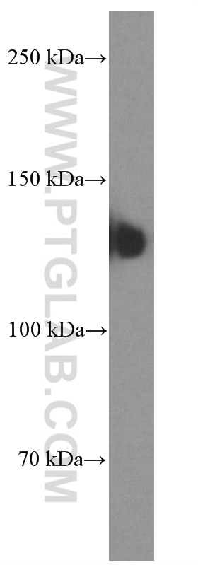 WB analysis of fetal human brain using 60238-1-Ig