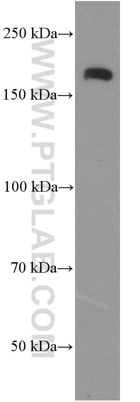 Western Blot (WB) analysis of C6 cells using NCAM1/CD56 Monoclonal antibody (60238-1-Ig)