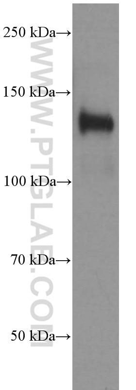 Western Blot (WB) analysis of pig brain tissue using NCAM1/CD56 Monoclonal antibody (60238-1-Ig)