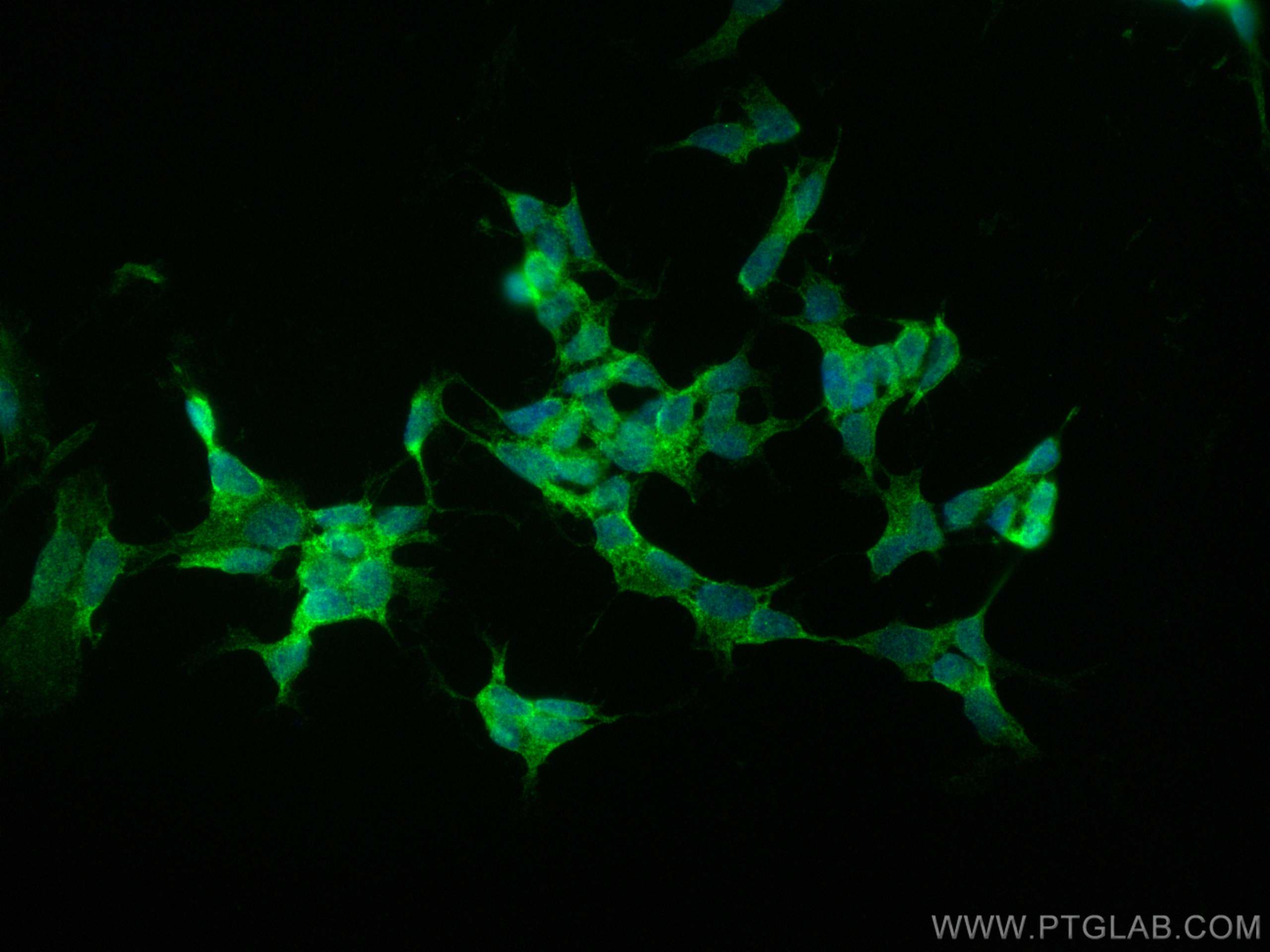Immunofluorescence (IF) / fluorescent staining of SH-SY5Y cells using NCAM1/CD56 Recombinant antibody (82715-1-RR)