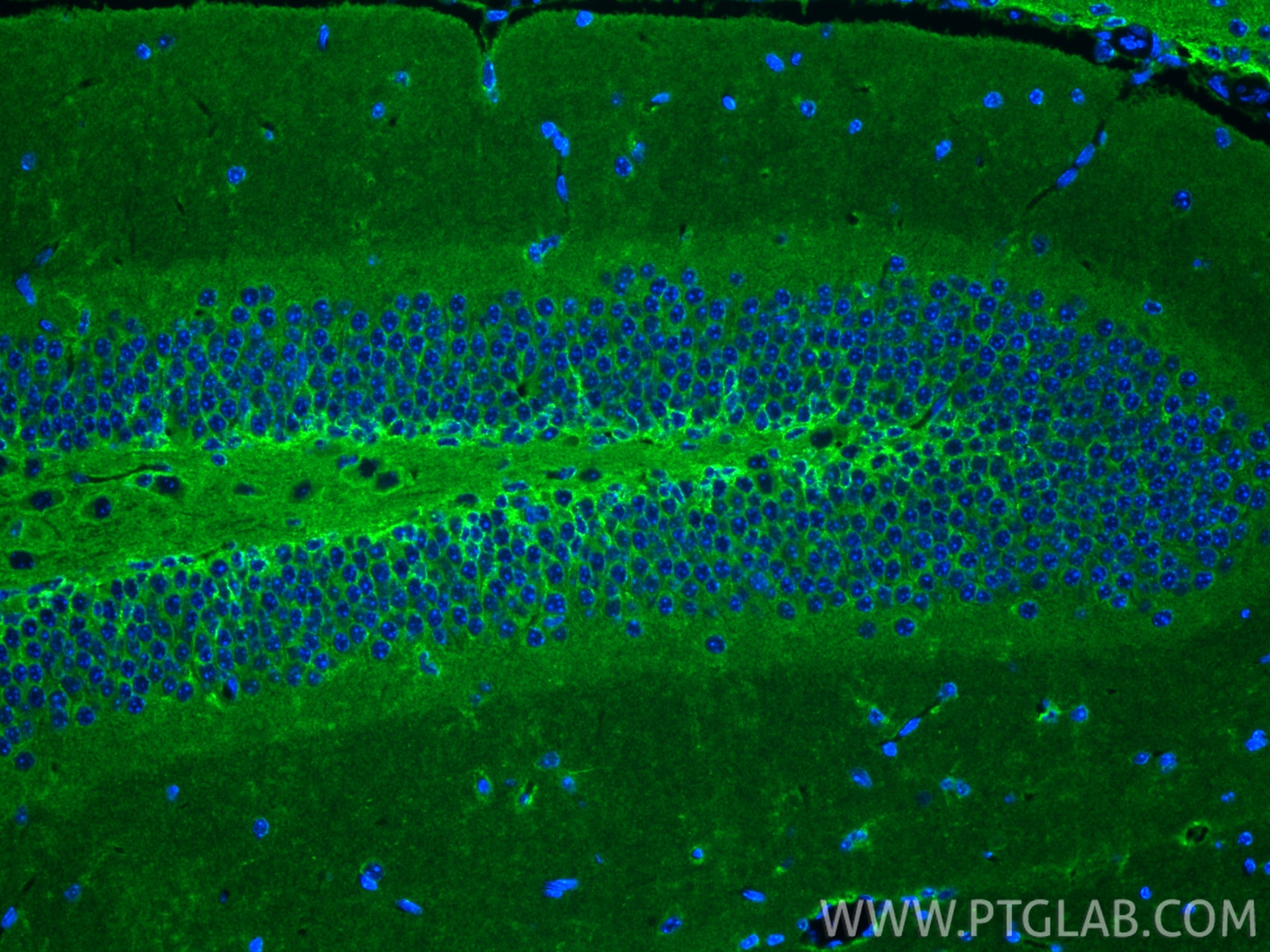 Immunofluorescence (IF) / fluorescent staining of mouse brain tissue using NCAM1/CD56 Recombinant monoclonal antibody (82715-1-RR)