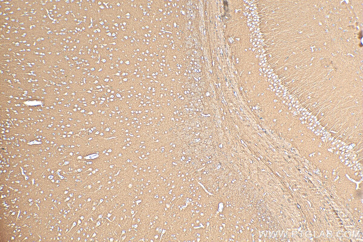 IHC staining of mouse brain using 82715-1-RR