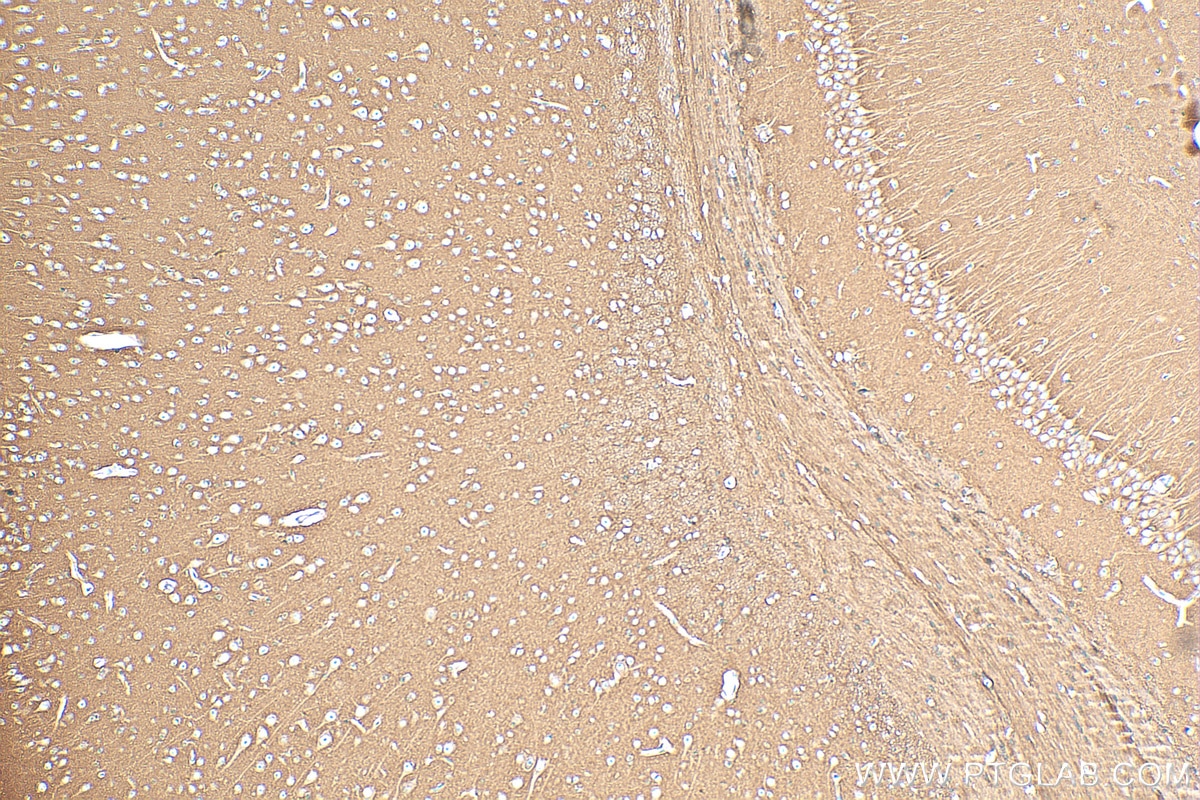 Immunohistochemistry (IHC) staining of mouse brain tissue using NCAM1/CD56 Recombinant antibody (82715-1-RR)