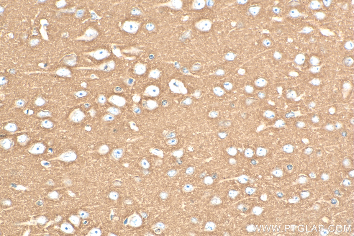 Immunohistochemistry (IHC) staining of mouse brain tissue using NCAM1/CD56 Recombinant antibody (82715-1-RR)