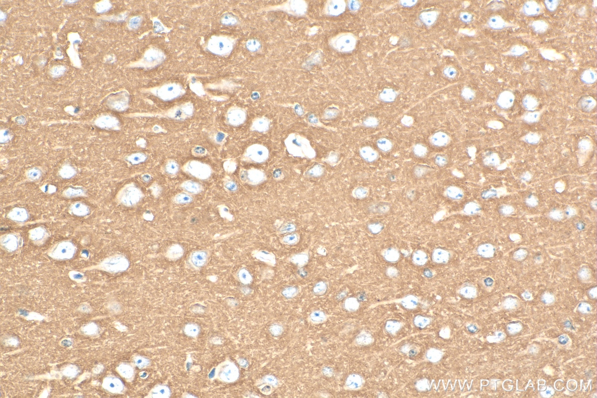 IHC staining of mouse brain using 82715-1-RR