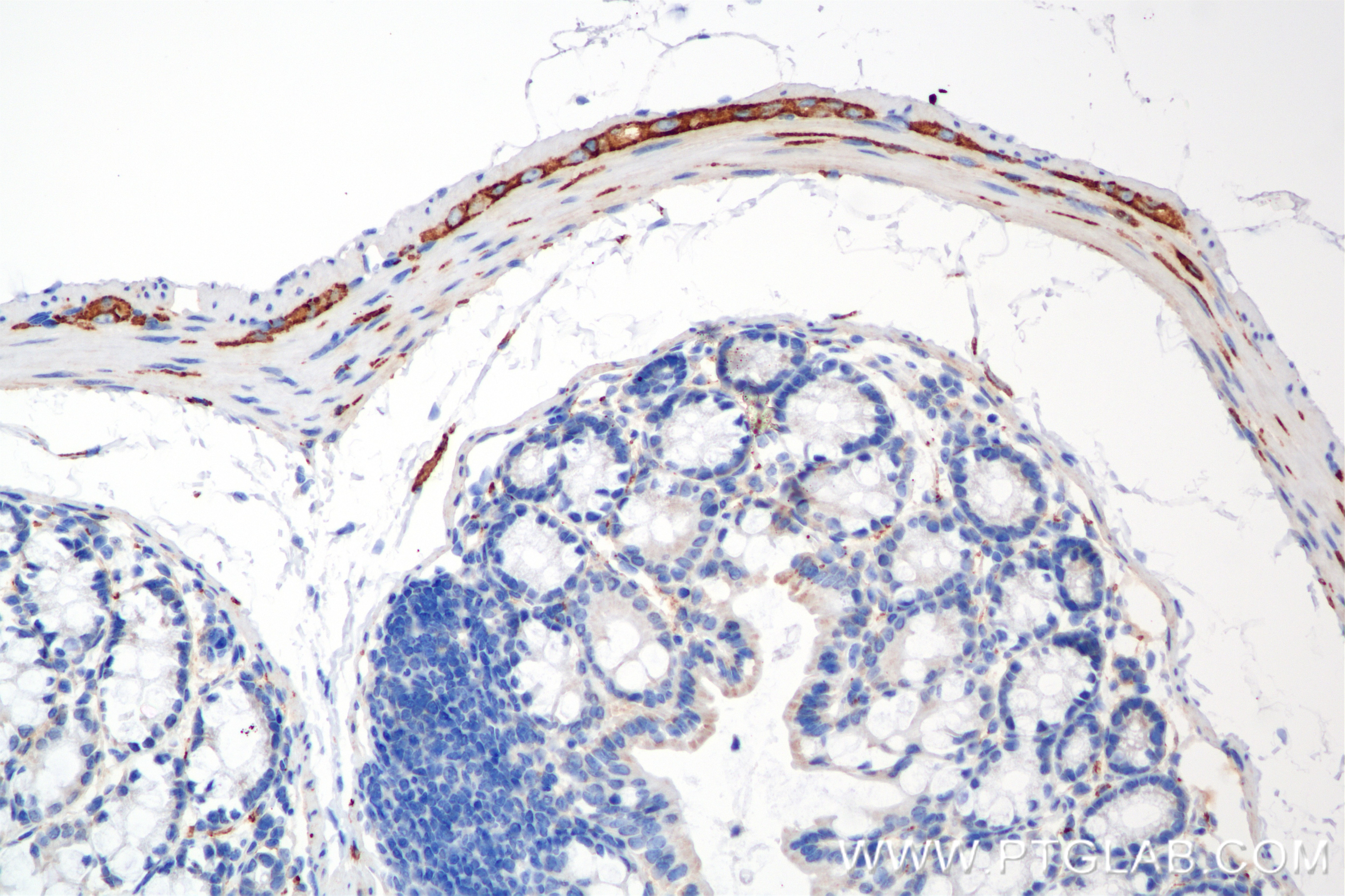Immunohistochemistry (IHC) staining of mouse colon tissue using NCAM1/CD56 Recombinant antibody (82715-1-RR)
