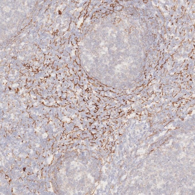 IHC staining of human tonsillitis using 82715-1-RR Immunohistochemistry (IHC) staining of human tonsillitis tissue using NCAM1/CD56 Recombinant monoclonal antibody (82715-1-RR)