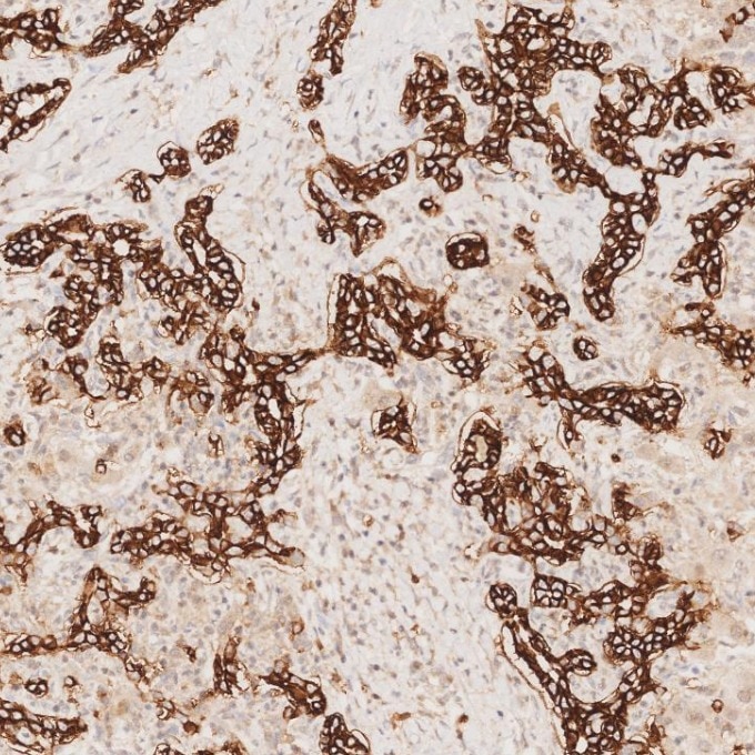 IHC staining of human liver using 82715-1-RR Immunohistochemistry (IHC) staining of human liver tissue using NCAM1/CD56 Recombinant monoclonal antibody (82715-1-RR)