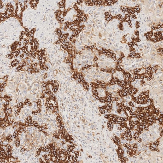 IHC staining of human liver using 82715-1-RR Immunohistochemistry (IHC) staining of human liver tissue using NCAM1/CD56 Recombinant monoclonal antibody (82715-1-RR)
