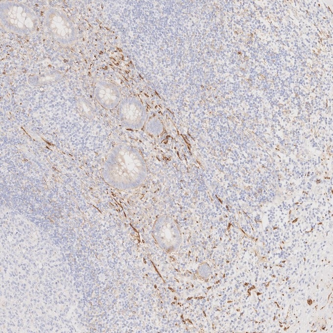 IHC staining of human appendicitis using 82715-1-RR Immunohistochemistry (IHC) staining of human appendicitis tissue using NCAM1/CD56 Recombinant monoclonal antibody (82715-1-RR)