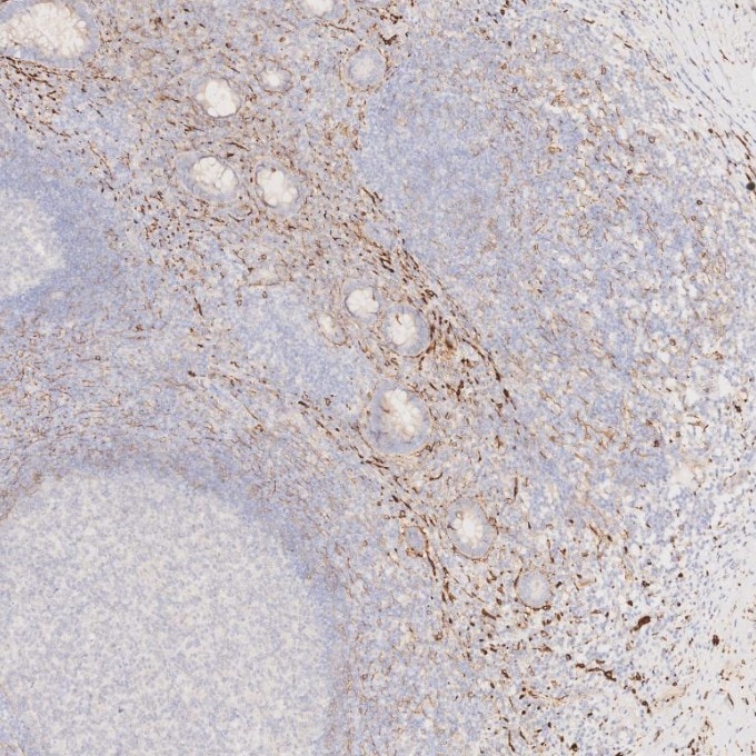 IHC staining of human appendicitis using 82715-1-RR Immunohistochemistry (IHC) staining of human appendicitis tissue using NCAM1/CD56 Recombinant monoclonal antibody (82715-1-RR)