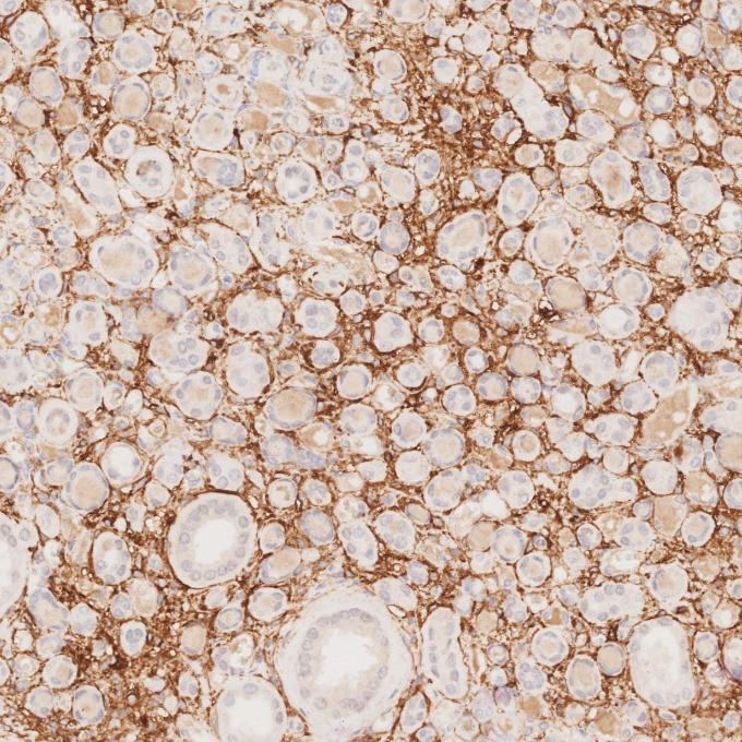 IHC staining of human kidney using 82715-1-RR Immunohistochemistry (IHC) staining of human kidney tissue using NCAM1/CD56 Recombinant monoclonal antibody (82715-1-RR)