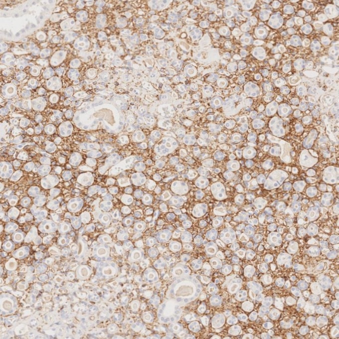IHC staining of human kidney using 82715-1-RR Immunohistochemistry (IHC) staining of human kidney tissue using NCAM1/CD56 Recombinant monoclonal antibody (82715-1-RR)