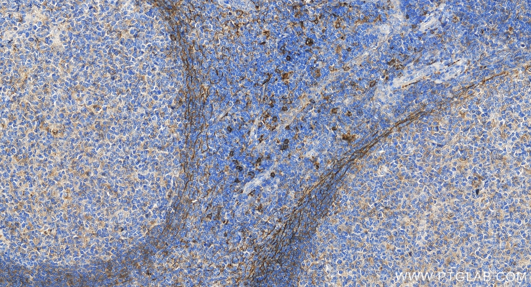Immunohistochemistry (IHC) staining of human tonsillitis tissue using NCAM1/CD56 Recombinant monoclonal antibody (82715-1-RR)