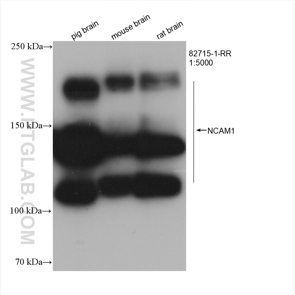 Western Blot (WB) analysis of various lysates using NCAM1/CD56 Recombinant antibody (82715-1-RR)