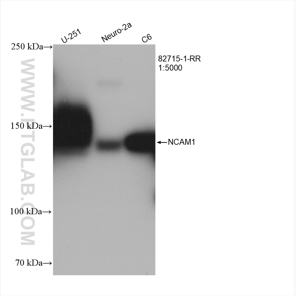 Western Blot (WB) analysis of U-251 cells using NCAM1/CD56 Recombinant antibody (82715-1-RR)