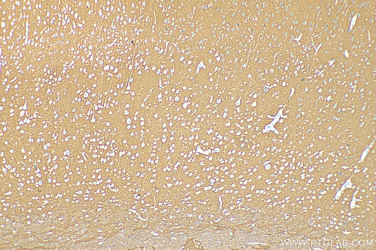 Immunohistochemistry (IHC) staining of mouse brain tissue using NCAM1/CD56 Polyclonal antibody (31536-1-AP)