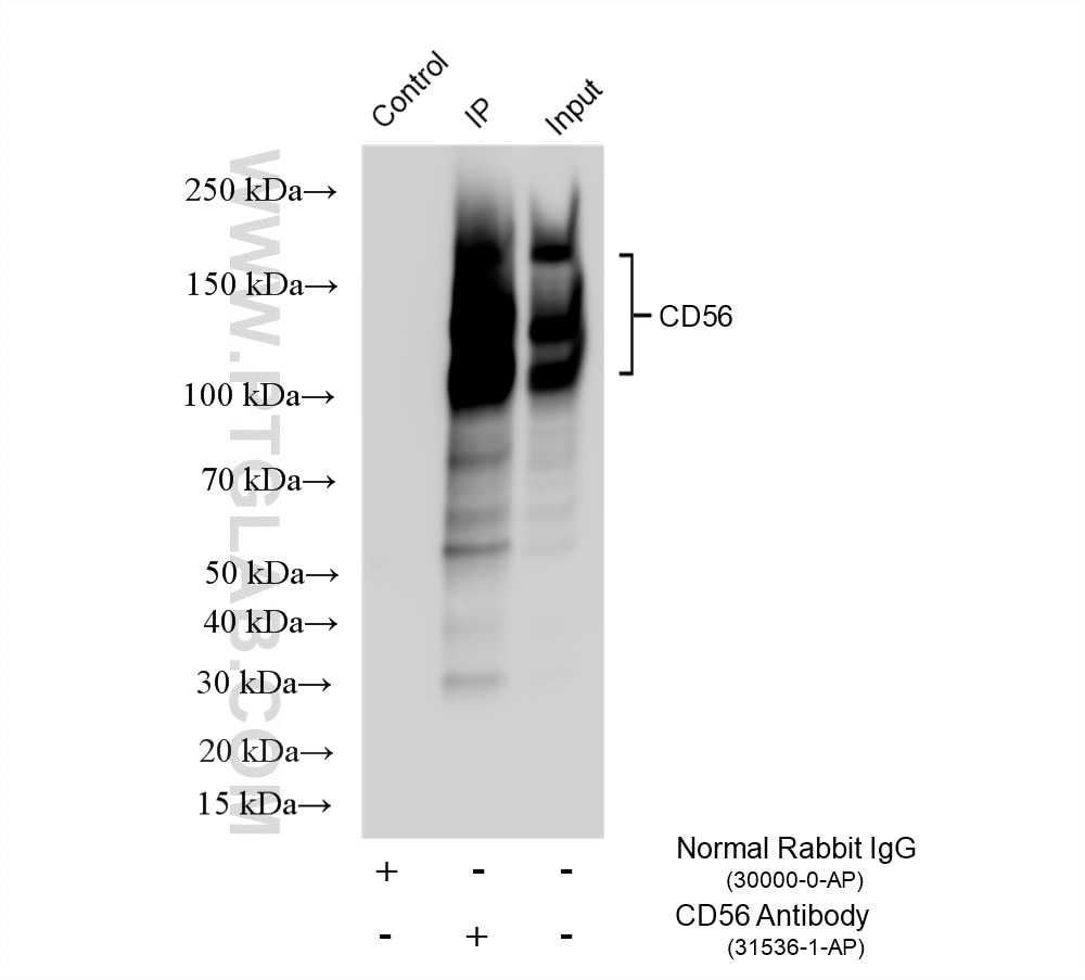 Immunoprecipitation (IP) experiment of mouse brain tissue using NCAM1/CD56 Polyclonal antibody (31536-1-AP)