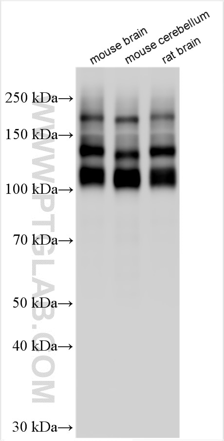 Western Blot (WB) analysis of various lysates using NCAM1/CD56 Polyclonal antibody (31536-1-AP)