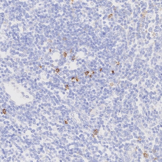 IHC staining of human tonsillitis using 82715-3-RR Immunohistochemistry (IHC) staining of human tonsillitis tissue using NCAM1/CD56 Recombinant monoclonal antibody (82715-3-RR)