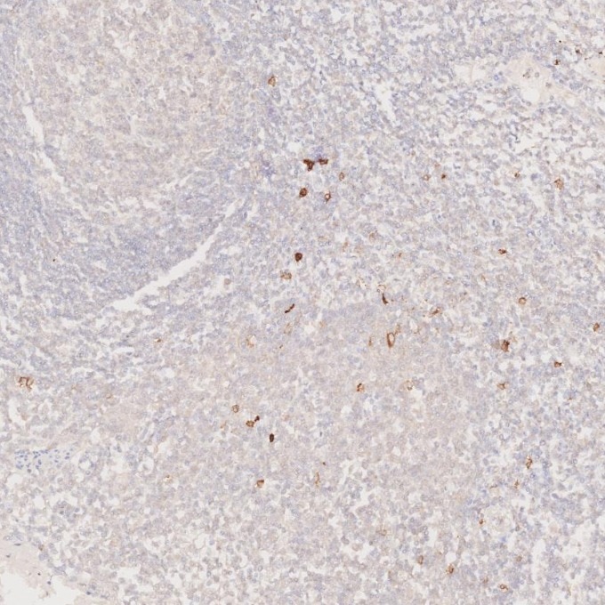 IHC staining of human tonsillitis using 82715-3-RR Immunohistochemistry (IHC) staining of human tonsillitis tissue using NCAM1/CD56 Recombinant monoclonal antibody (82715-3-RR)