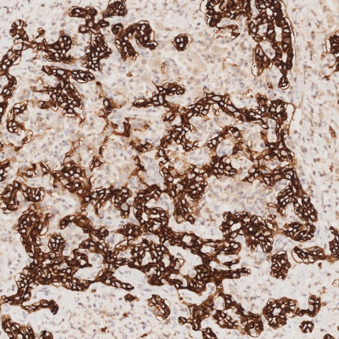 IHC staining of human liver using 82715-3-RR Immunohistochemistry (IHC) staining of human liver tissue using NCAM1/CD56 Recombinant monoclonal antibody (82715-3-RR)