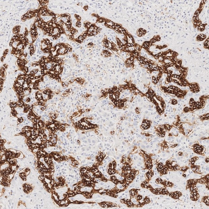 IHC staining of human liver using 82715-3-RR Immunohistochemistry (IHC) staining of human liver tissue using NCAM1/CD56 Recombinant monoclonal antibody (82715-3-RR)