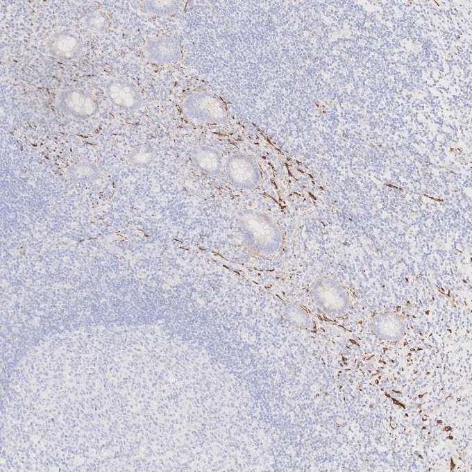 IHC staining of human appendicitis using 82715-3-RR Immunohistochemistry (IHC) staining of human appendicitis tissue using NCAM1/CD56 Recombinant monoclonal antibody (82715-3-RR)