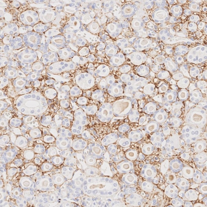 IHC staining of human kidney using 82715-3-RR Immunohistochemistry (IHC) staining of human kidney tissue using NCAM1/CD56 Recombinant monoclonal antibody (82715-3-RR)