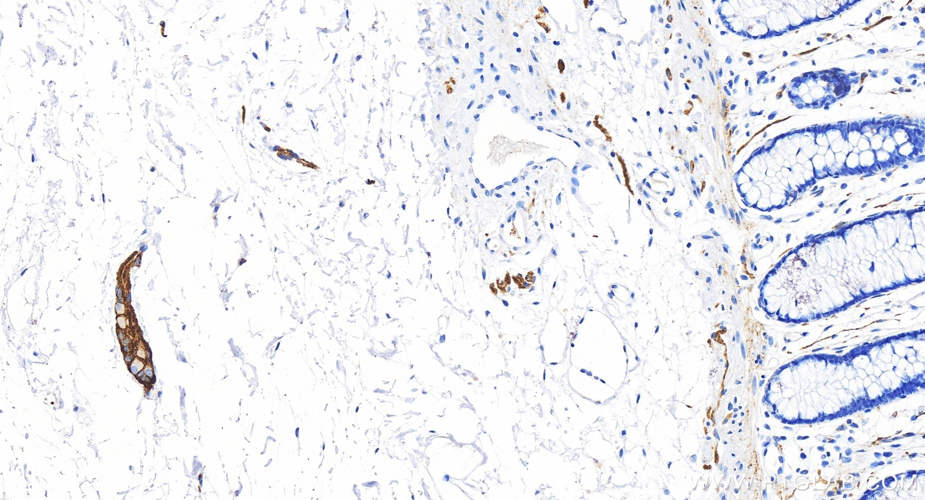 Immunohistochemistry (IHC) staining of human colon tissue using NCAM1/CD56 Recombinant antibody (83365-6-RR)