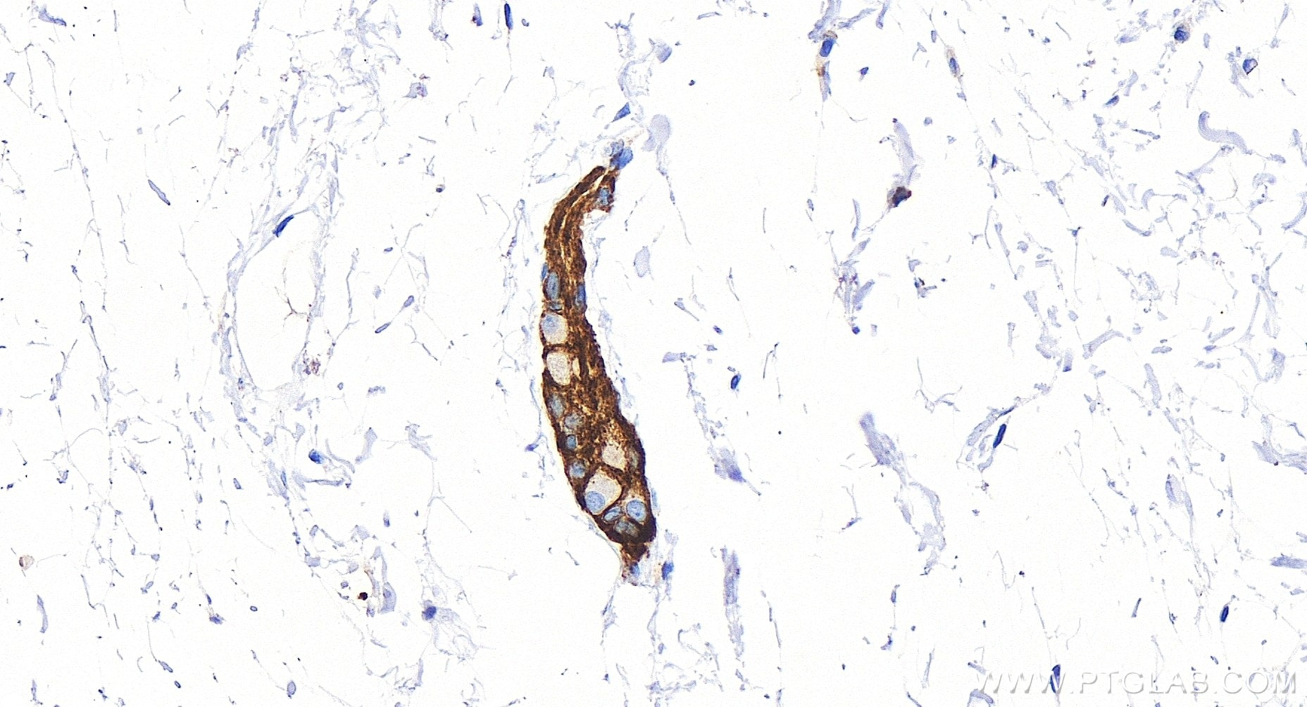 Immunohistochemistry (IHC) staining of human colon tissue using NCAM1/CD56 Recombinant antibody (83365-6-RR)