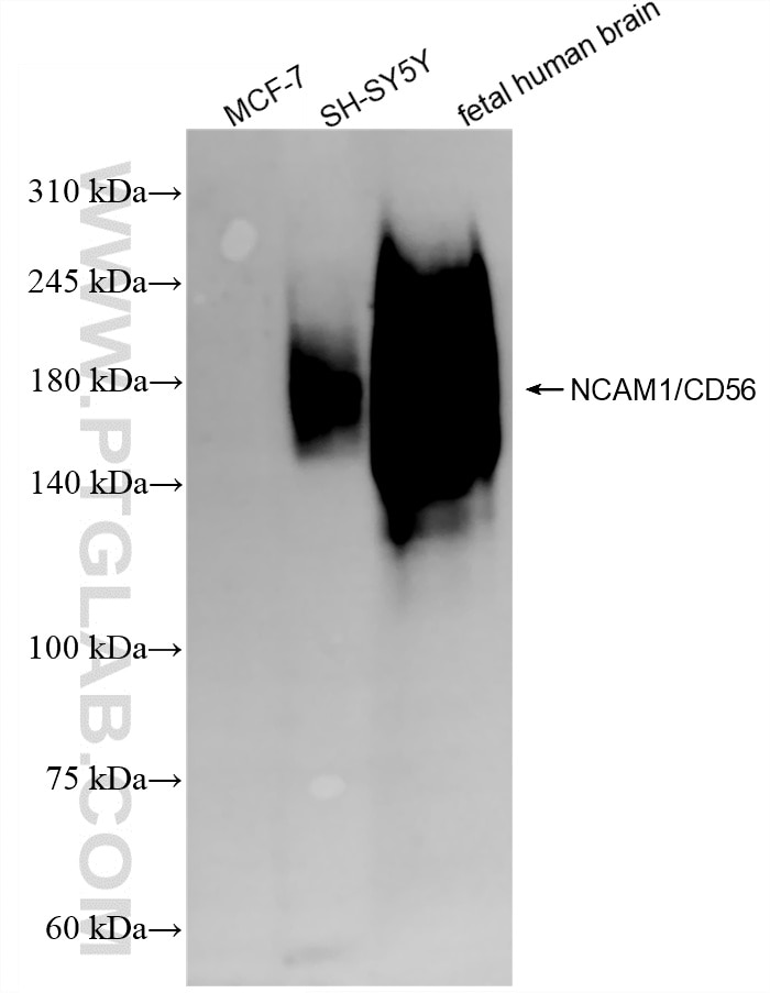 Western Blot (WB) analysis of various lysates using NCAM1/CD56 Recombinant monoclonal antibody (83365-6-RR)