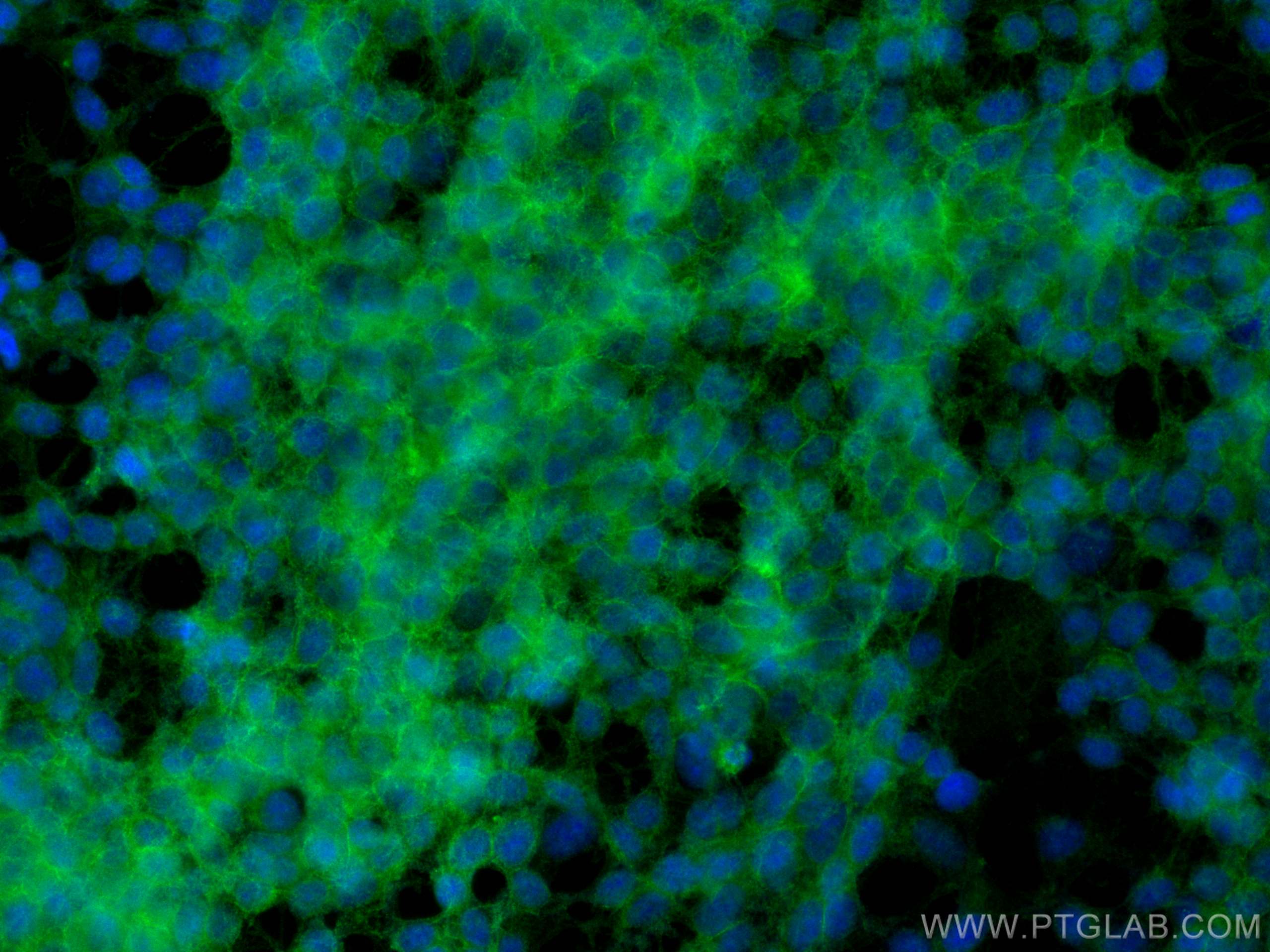 Immunofluorescence (IF) / fluorescent staining of SH-SY5Y cells using CoraLite® Plus 488-conjugated NCAM1/CD56 Monoclona (CL488-60238)
