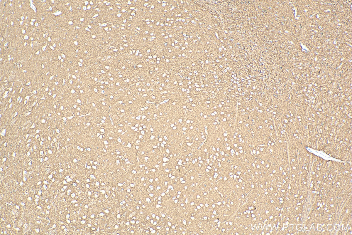 IHC staining of mouse brain using 13850-1-AP
