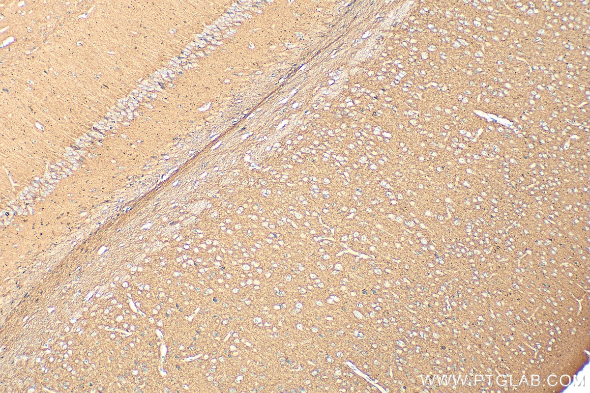 Immunohistochemistry (IHC) staining of mouse brain tissue using NCAM2 Polyclonal antibody (13850-1-AP)