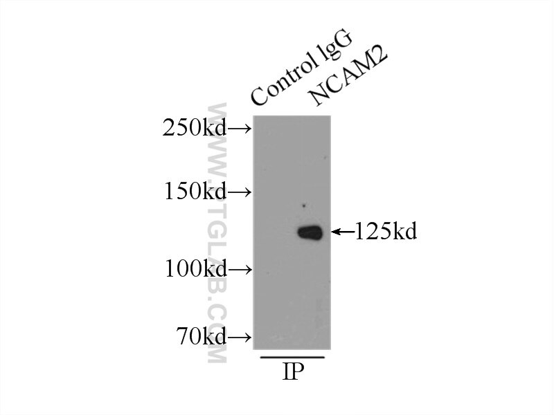 Immunoprecipitation (IP) experiment of mouse brain tissue using NCAM2 Polyclonal antibody (13850-1-AP)