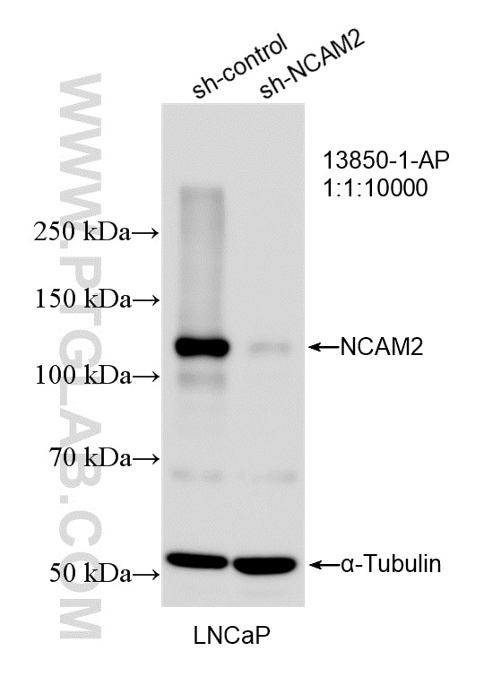 WB result of NCAM2 antibody (13850-1-AP; 1:10000; incubated at room temperature for 1.5 hours) with sh-Control and sh-NCAM2 transfected LNCaP cells. Western Blot (WB) analysis of LNCaP cells using NCAM2 Polyclonal antibody (13850-1-AP)