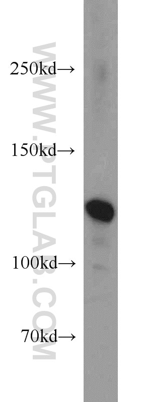 Western Blot (WB) analysis of human brain tissue using NCAM2 Polyclonal antibody (13850-1-AP)