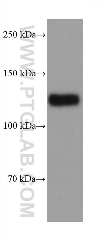 Western Blot (WB) analysis of LNCaP cells using NCAM2 Monoclonal antibody (68205-1-Ig)