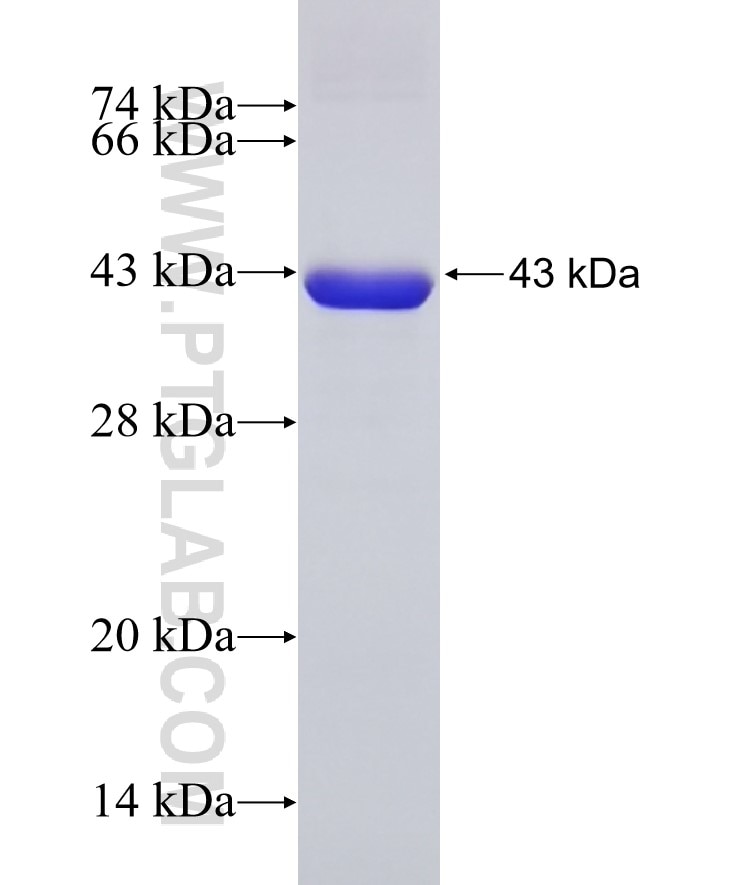NCAM2 fusion protein Ag4935 SDS-PAGE