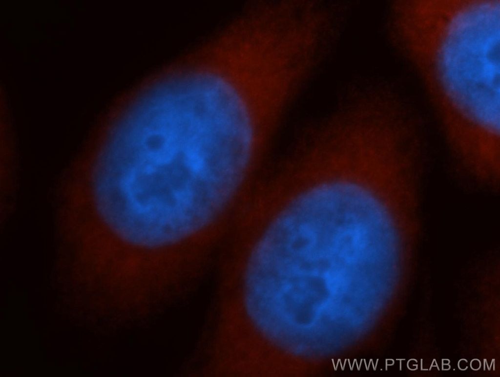 Immunofluorescence (IF) / fluorescent staining of HeLa cells using NCAPD2 Polyclonal antibody (13382-1-AP)